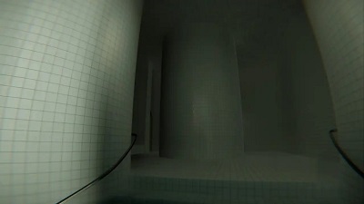 池核后室(图1)