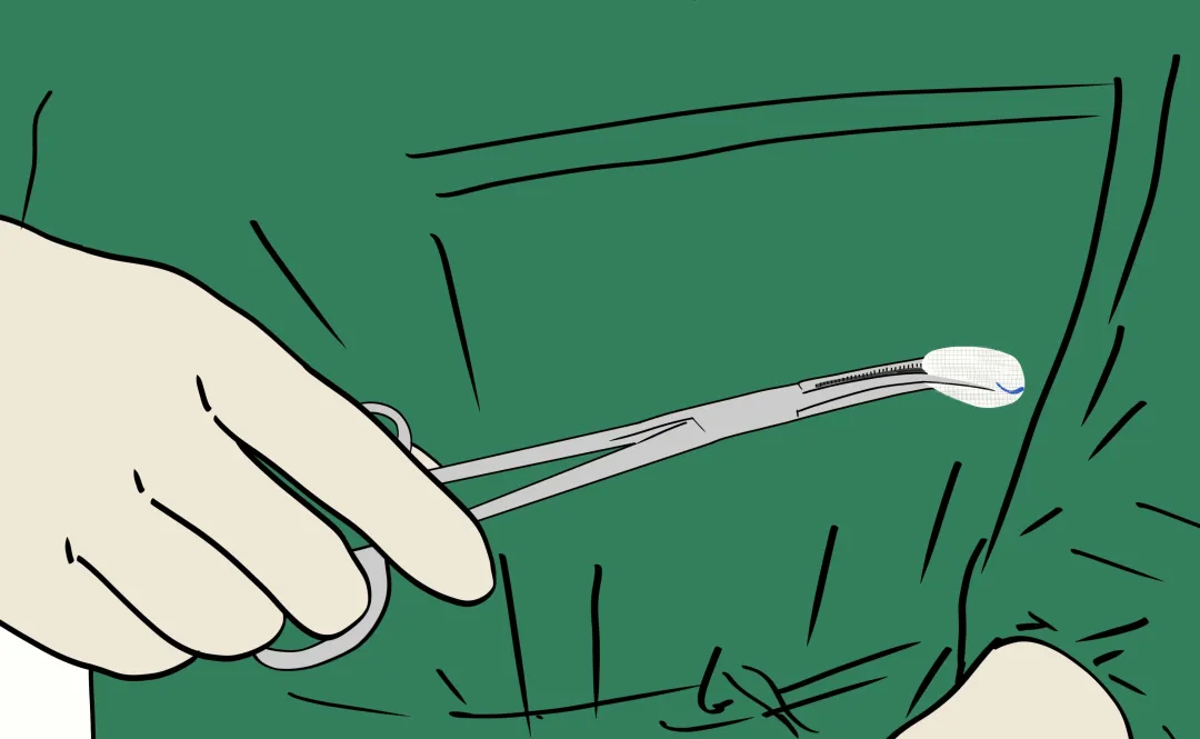 边做手术边吃零食？手术室里的花生米原来有大作用！(图3)