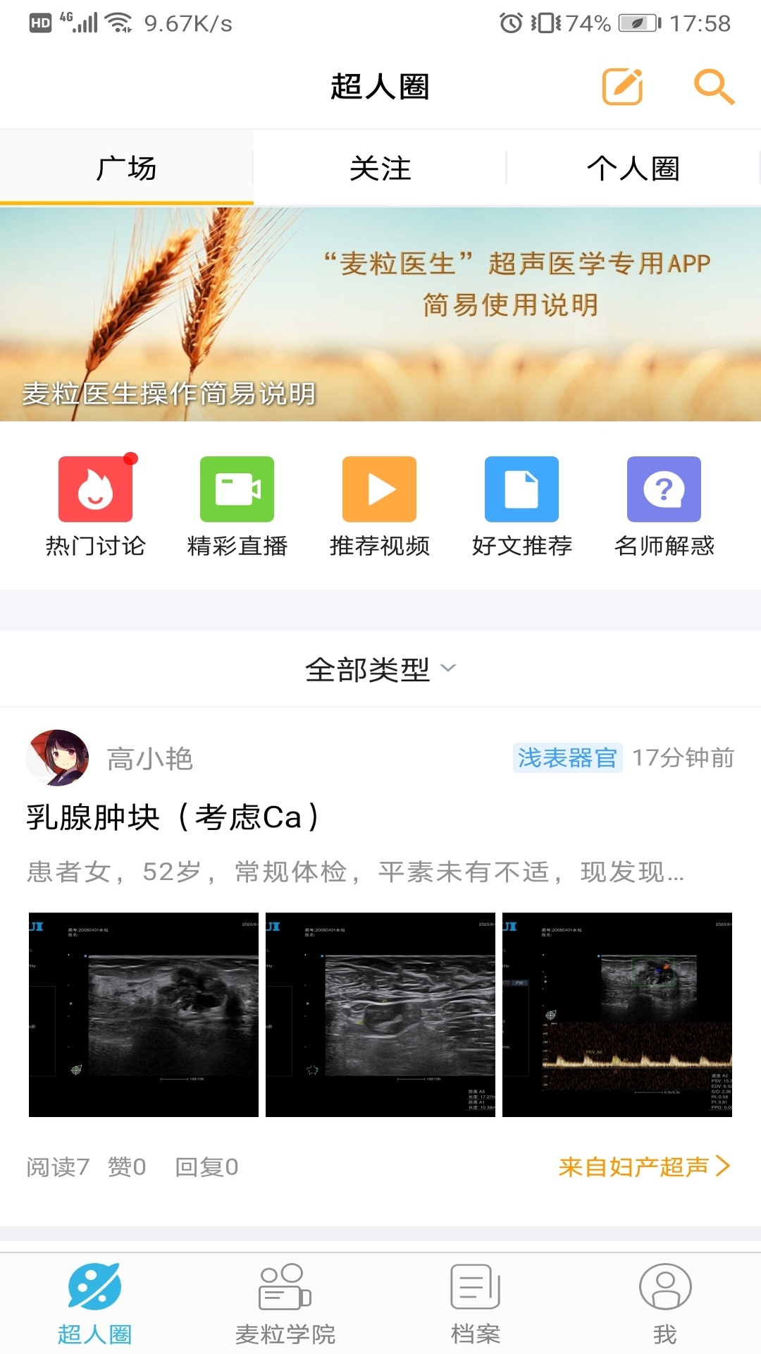 
麦粒医生app