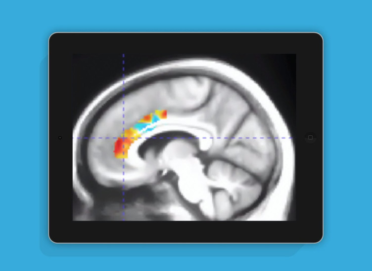美国研究显示特定训练游戏可显著延缓老年认知衰退