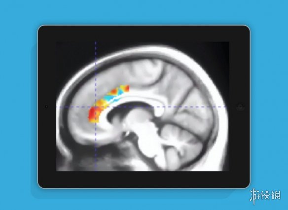 美国研究显示特定训练游戏可显著延缓老年认知衰退(图1) 美国研究显示特定训练游戏可显著延缓老年认知衰退(图1)