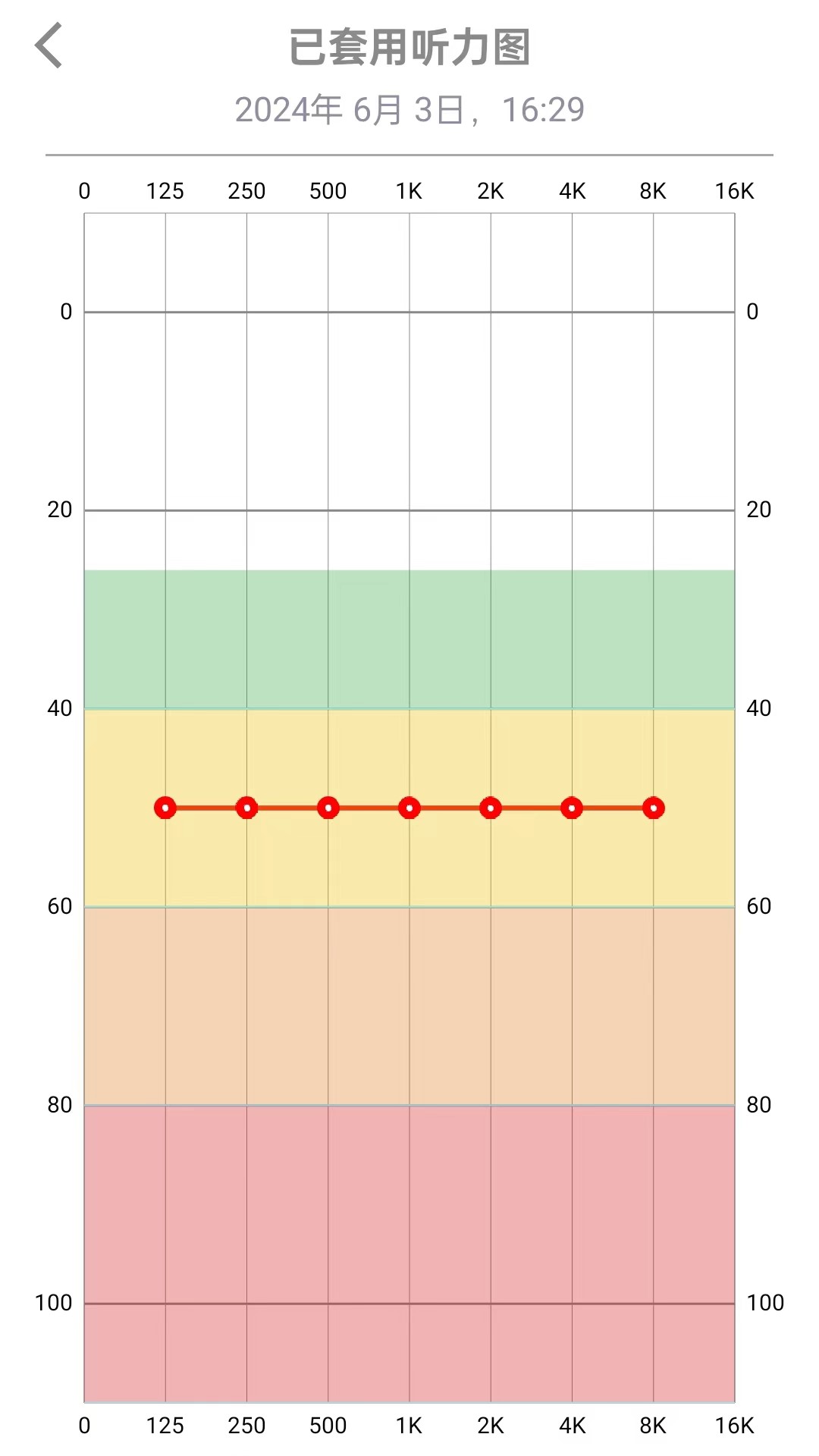 TINX町石助听器(图1)