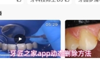 牙匠之家app动态删除方法