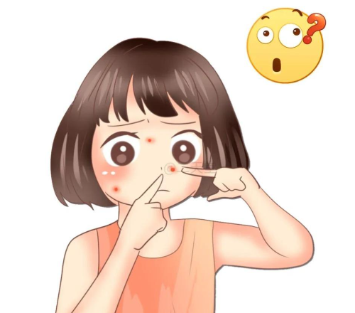 脸上长痘，挤掉好得更快吗？