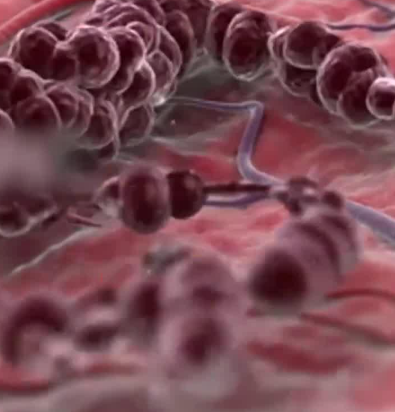 肿瘤和癌症是一回事吗？